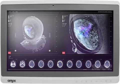 Onyx-Zeus-248 Professional Medical AIO i7-6600U/8GB/256GB SSD NEW *TouchScreen* *No Stand*
